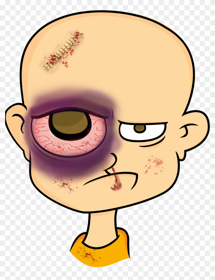 A 21 Year Old Man Was Minding His Own Business On A - Cartoon Man With Black Eye - Free Transparent PNG Clipart Images Download A 21 Year Old Man Was Minding His Own Business On A - Cartoon Man With Black Eye - Free Transparent PNG Clipart Images Download
