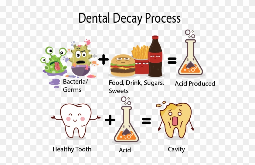 Dental Decay, Also Known As A Cavity, Is The Breakdown - Process Of Tooth Decay #439906