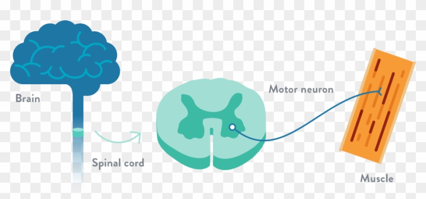 How Muscles Are Affected By Sma - Incidence Of Spinal Muscular Atrophy #452895