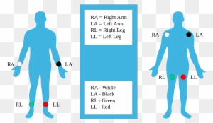 Two Common Electrodes Used Are A Flat Paper Thin Sticker - 4 Lead Ecg Electrode Placement