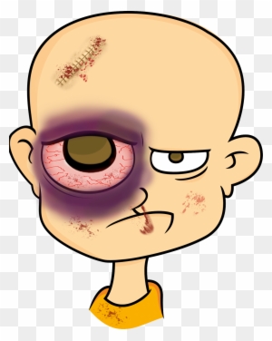 A 21 Year Old Man Was Minding His Own Business On A - Cartoon Man With Black Eye